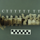 A vertebrae-on-pole shown in isolation. The annotations refer to lumbar (L), cervical (C), and thoracic (T) elements of the human vertebrae.